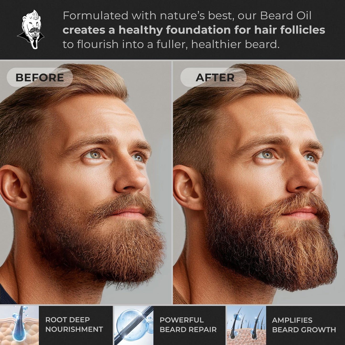 Hypoallergenic All Natural Beard Oil for Men - Lion'S Den, 30Ml Nut Free Made from Seed Beard Oil for Men Growth for Sensitive Skin, Mustache Softener, Mustache Conditioner and Moisturizer