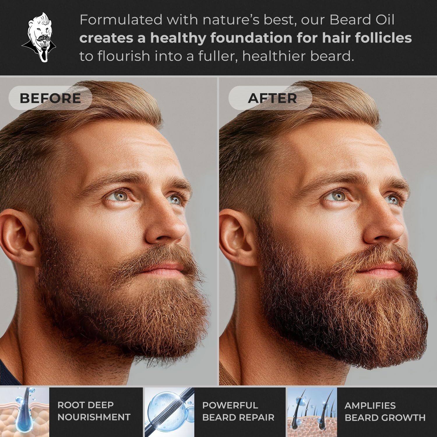 Hypoallergenic All Natural Beard Oil for Men - Lion'S Den, 30Ml Nut Free Made from Seed Beard Oil for Men Growth for Sensitive Skin, Mustache Softener, Mustache Conditioner and Moisturizer